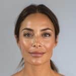 Astounding Discovery: Botox to Slim Your Face Effortlessly. Astounding Discovery: Botox to Slim Your Face Effortlessly.